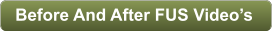 Before And After FUS Videos