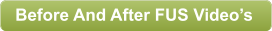 Before And After FUS Videos